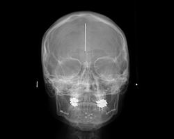 Radiología Frontal